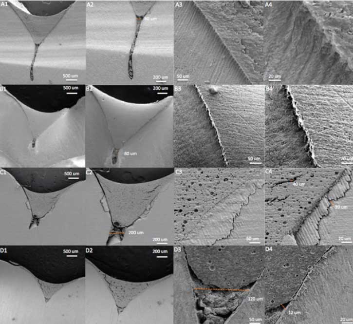 Figura 4. Imágenes del Microscopio electrónico de barrido que muestran el efecto de los selladores Clinpro® y Embrace Wet-Bond® (1-4 500, 200, 50, 20 um).